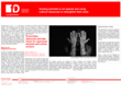 fD Brochure